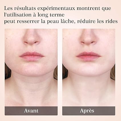 Appareil de Beauté pour le Soin du Visage et du Cou